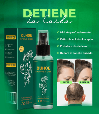 Elhoe Crecimiento Para El Cabello | 2x1: Crecimiento y Control de Caída – 100%Natural